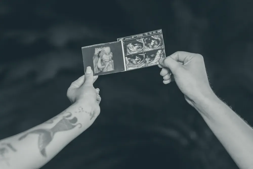 Duas mãos seguram um par de fotos de ultrassom contra um fundo escuro